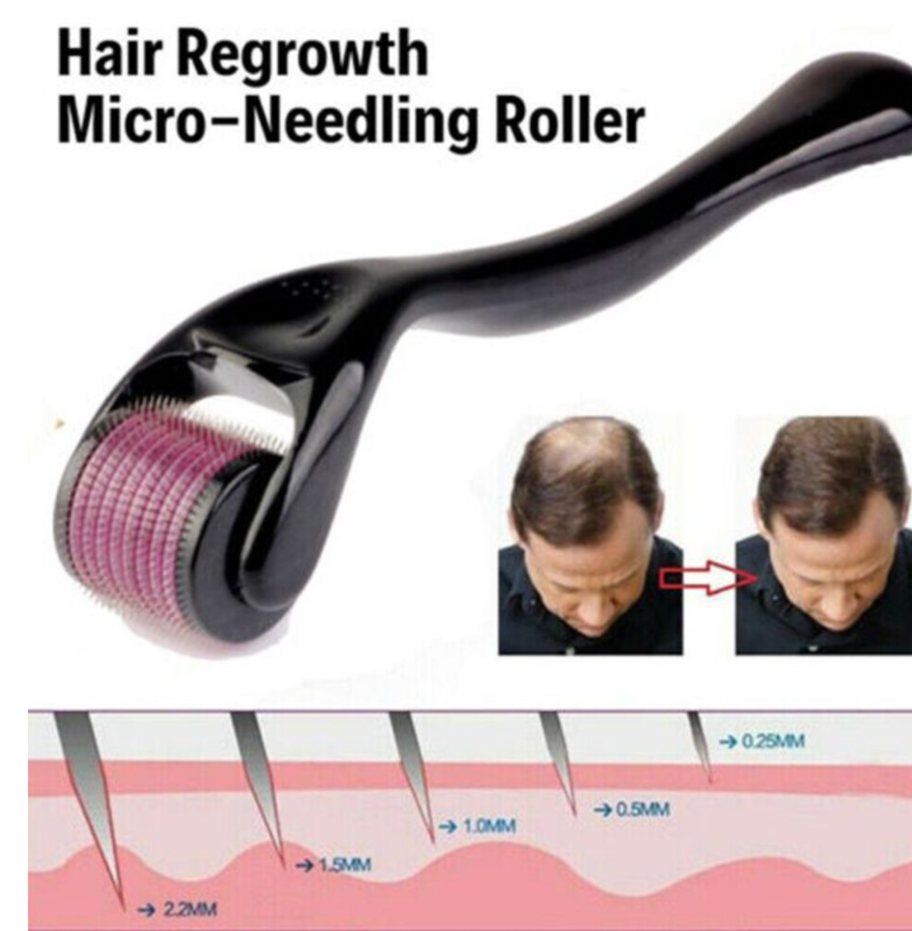 Derma Roller | Micro Needling Treatment