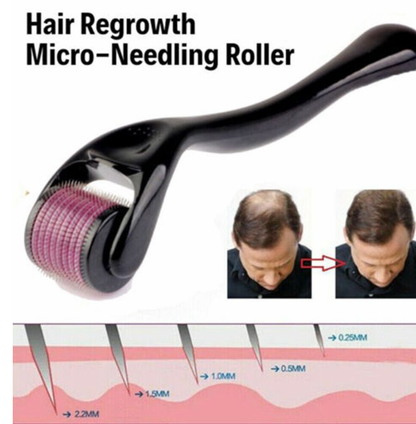 Derma Roller | Micro Needling Treatment